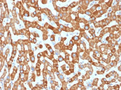 Immunohistochemistry (Formalin/PFA-fixed paraffin-embedded sections) - Anti-Prohibitin antibody [PHB/1881] (AB224653)
