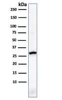 Western blot - Anti-Prohibitin antibody [PHB/1881] (AB224653)