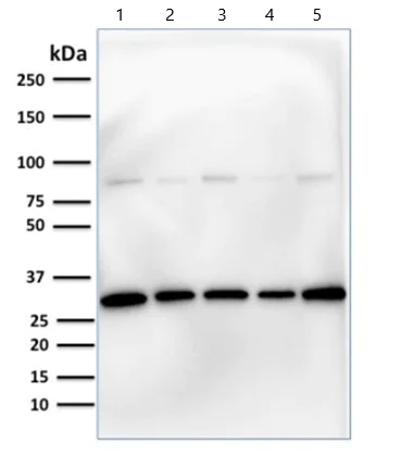 Western blot - Anti-Prohibitin antibody [PHB/1881] (AB224653)