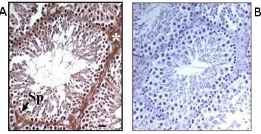 Immunohistochemistry (Formalin/PFA-fixed paraffin-embedded sections) - Anti-Prokineticin 2/PK2 antibody (AB76747), expandable thumbnail