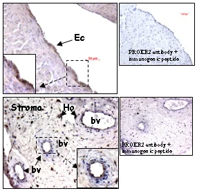 Immunohistochemistry (Formalin/PFA-fixed paraffin-embedded sections) - Anti-PROKR2 antibody - Membrane Vesicle Marker (AB42805)