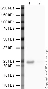 Western blot - Anti-Prolactin/PRL antibody (AB103617)