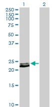 Western blot - Anti-Prolactin/PRL antibody (AB103617)