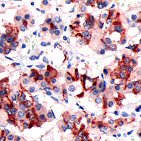 Immunohistochemistry (Formalin/PFA-fixed paraffin-embedded sections) - Anti-Prolactin/PRL antibody (AB64377)