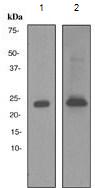 Western blot - Anti-Prolactin/PRL antibody [EP3215] (AB110642)