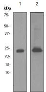 Western blot - Anti-Prolactin/PRL antibody [EP3215] - BSA and Azide free (AB284786)