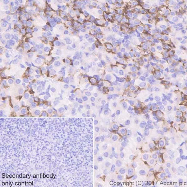 Immunohistochemistry (Formalin/PFA-fixed paraffin-embedded sections) - Anti-Prolactin/PRL antibody [EPR18018-31] (AB188229)