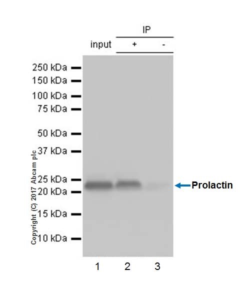 Immunoprecipitation - Anti-Prolactin/PRL antibody [EPR18018-31] (AB188229), expandable thumbnail