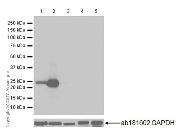 Western blot - Anti-Prolactin/PRL antibody [EPR18018-31] (AB188229)