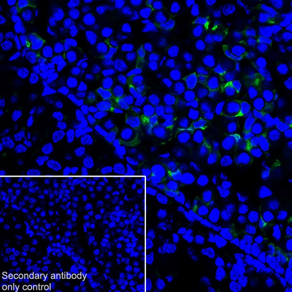 Immunohistochemistry (Frozen sections) - Anti-Prolactin/PRL antibody [EPR18018-31] - BSA and Azide free (AB226491)