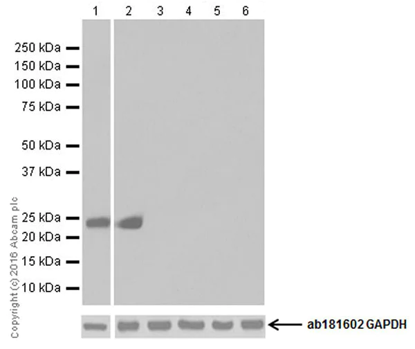 Western blot - Anti-Prolactin/PRL antibody [EPR19372] (AB183968)