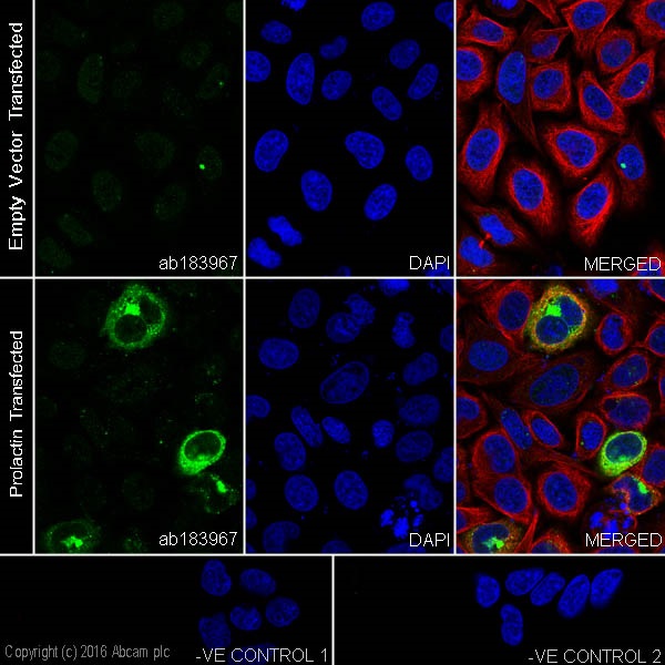 Immunocytochemistry/ Immunofluorescence - Anti-Prolactin/PRL antibody [EPR19386] (AB183967)