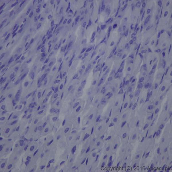 Immunohistochemistry (Formalin/PFA-fixed paraffin-embedded sections) - Anti-Prolactin/PRL antibody [EPR19386] (AB183967)