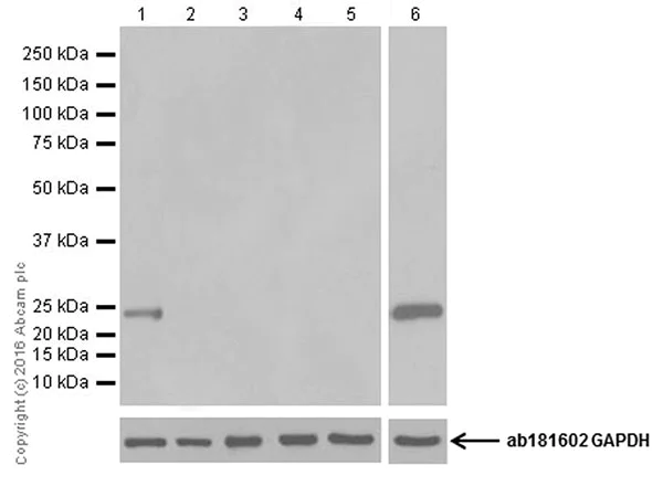 Western blot - Anti-Prolactin/PRL antibody [EPR19386] (AB183967)