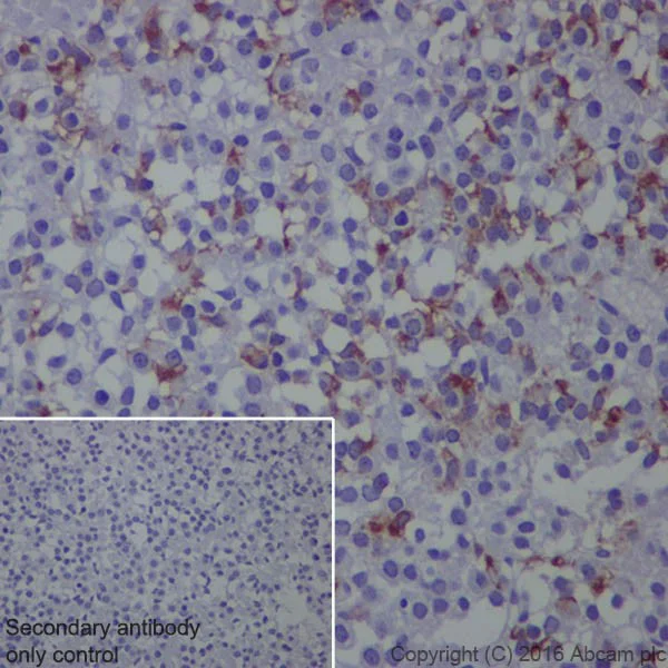 Immunohistochemistry (Formalin/PFA-fixed paraffin-embedded sections) - Anti-Prolactin/PRL antibody [EPR19386] - BSA and Azide free (AB238938)
