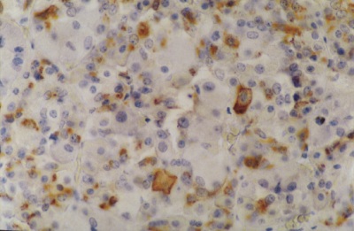 Immunohistochemistry (Formalin/PFA-fixed paraffin-embedded sections) - Anti-Prolactin/PRL antibody [INN-hPRL-1] (AB11301)