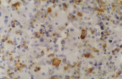 Immunohistochemistry (Formalin/PFA-fixed paraffin-embedded sections) - Anti-Prolactin/PRL antibody [INN-hPRL-1] (AB11301)