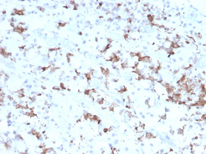 Immunohistochemistry (Formalin/PFA-fixed paraffin-embedded sections) - Anti-Prolactin/PRL antibody [PRL/2641] (AB268110)