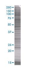 SDS-PAGE - Prolactin/PRL overexpression 293T lysate (whole cell) (AB94057), expandable thumbnail