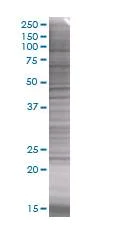 SDS-PAGE - Prolactin/PRL overexpression 293T lysate (whole cell) (AB94057)