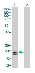 Western blot - Prolactin/PRL overexpression 293T lysate (whole cell) (AB94057)