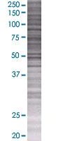 SDS-PAGE - Prolactin Receptor overexpression 293T lysate (whole cell) (AB94257)
