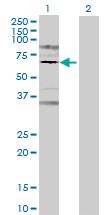 Western blot - Prolactin Receptor overexpression 293T lysate (whole cell) (AB94257), expandable thumbnail