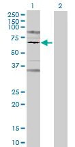 Western blot - Prolactin Receptor overexpression 293T lysate (whole cell) (AB94257)