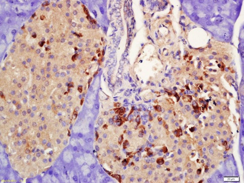 Immunohistochemistry (Formalin/PFA-fixed paraffin-embedded sections) - Anti-Prolactin Receptor/PRL-R antibody (AB214303)