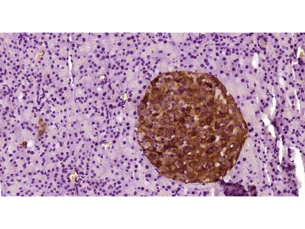 Immunohistochemistry (Formalin/PFA-fixed paraffin-embedded sections) - Anti-Prolactin Receptor/PRL-R antibody (AB214303)