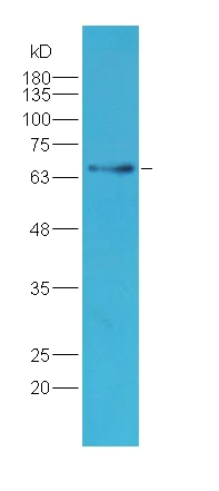 Western blot - Anti-Prolactin Receptor/PRL-R antibody (AB214303)