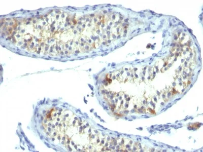 Immunohistochemistry (Formalin/PFA-fixed paraffin-embedded sections) - Anti-Prolactin Receptor/PRL-R antibody [B6.2] (AB233958)