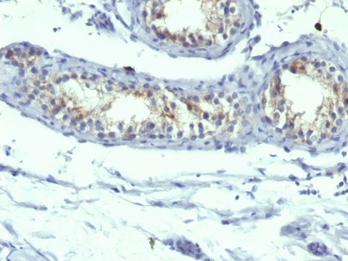 Immunohistochemistry (Formalin/PFA-fixed paraffin-embedded sections) - Anti-Prolactin Receptor/PRL-R antibody [B6.2 + PRLR742] (AB199015), expandable thumbnail