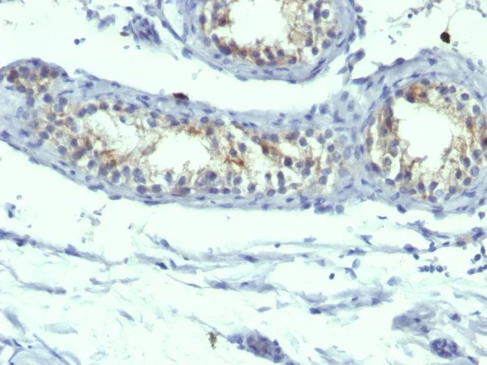 Immunohistochemistry (Formalin/PFA-fixed paraffin-embedded sections) - Anti-Prolactin Receptor/PRL-R antibody [B6.2 + PRLR742] (AB199015)