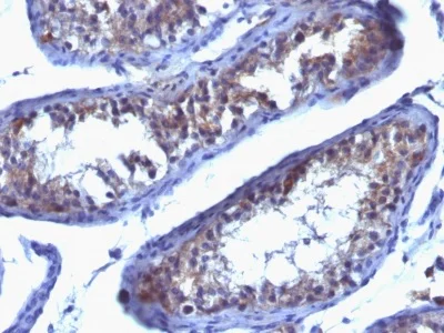 Immunohistochemistry (Formalin/PFA-fixed paraffin-embedded sections) - Anti-Prolactin Receptor/PRL-R antibody [SPM213] - BSA and Azide free (AB212747)