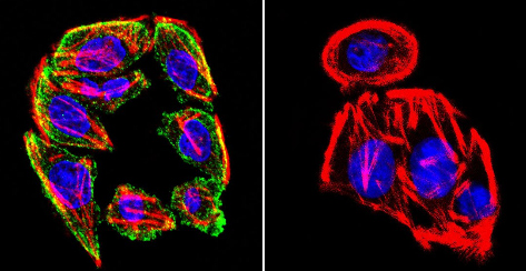 Immunocytochemistry/ Immunofluorescence - Anti-Prolactin Receptor/PRL-R antibody [T6] (AB2773)