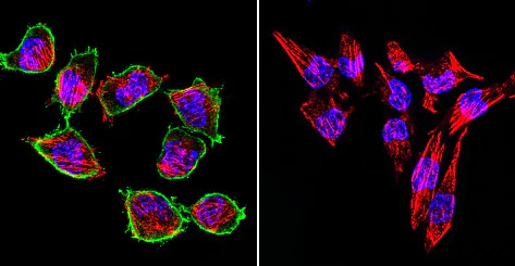 Immunocytochemistry/ Immunofluorescence - Anti-Prolactin Receptor/PRL-R antibody [T6] (AB2773)