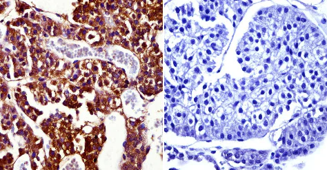 Immunohistochemistry (Formalin/PFA-fixed paraffin-embedded sections) - Anti-Prolactin Receptor/PRL-R antibody [T6] (AB2773)