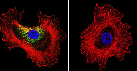 Immunocytochemistry/ Immunofluorescence - Anti-Prolactin Receptor/PRL-R antibody [U5] (AB2772), expandable thumbnail