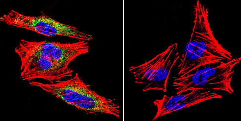Immunocytochemistry/ Immunofluorescence - Anti-Prolactin Receptor/PRL-R antibody [U5] (AB2772), expandable thumbnail