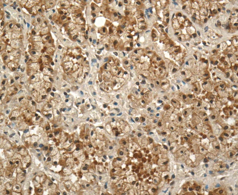 Immunohistochemistry (Formalin/PFA-fixed paraffin-embedded sections) - Anti-Prolactin Receptor/PRL-R antibody [U5] (AB2772)