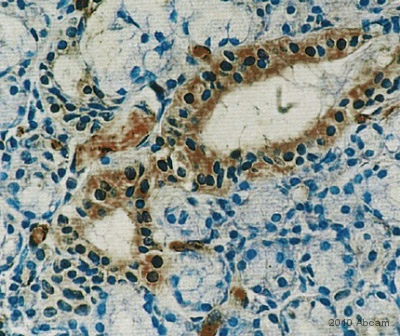 Immunohistochemistry (Formalin/PFA-fixed paraffin-embedded sections) - Anti-Prolactin Receptor/PRL-R antibody [U5] (ab2772), expandable thumbnail