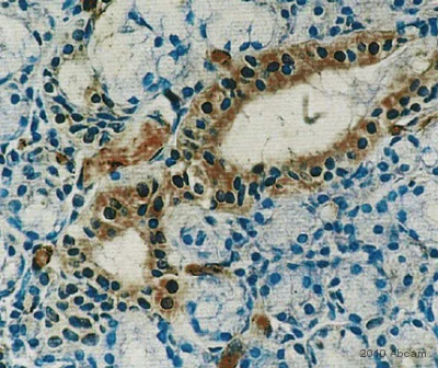 Immunohistochemistry (Formalin/PFA-fixed paraffin-embedded sections) - Anti-Prolactin Receptor/PRL-R antibody [U5] (AB2772)