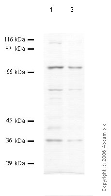 Western blot - Anti-Prolyl Endopeptidase antibody (AB58993)