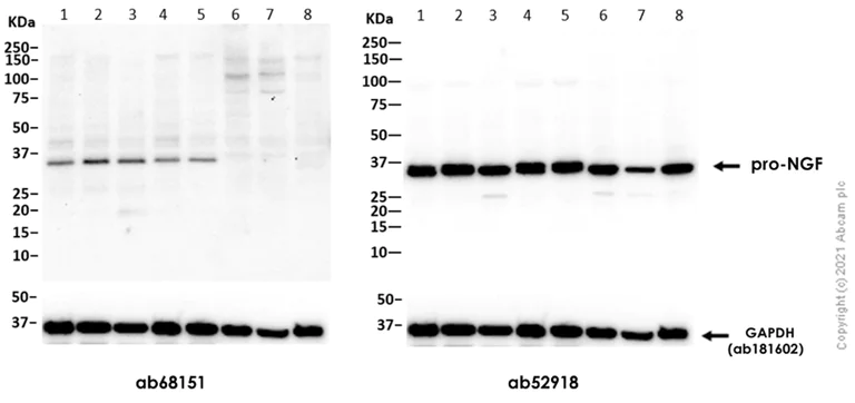 Western blot - Anti-proNGF antibody [EP1318Y] (AB68151)