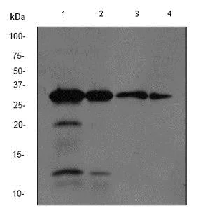 Western blot - Anti-proNGF antibody [EP1318Y] - BSA and Azide free (AB247365)