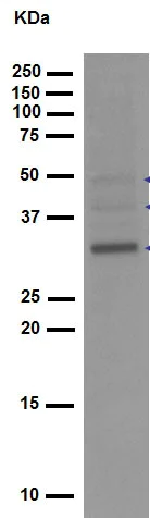 Western blot - Anti-proNGF antibody [EP1318Y] - BSA and Azide free (AB247365)