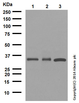 Western blot - Anti-proNGF antibody [EP1320Y] (AB52918), expandable thumbnail