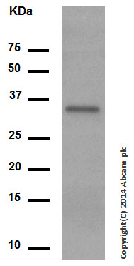 Western blot - Anti-proNGF antibody [EP1320Y] (AB52918), expandable thumbnail