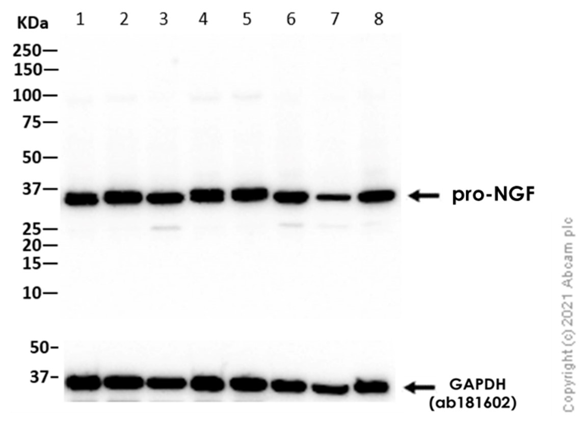Western blot - Anti-proNGF antibody [EP1320Y] (AB52918), expandable thumbnail
